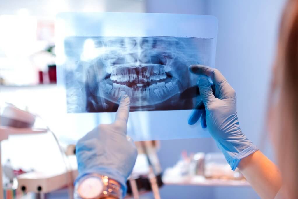 Benefits-Of-Digital-Dental-X-Rays